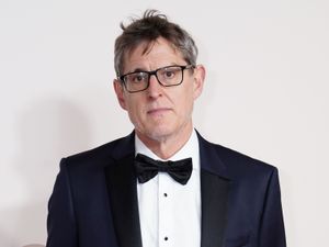 Supporting image for story: Louis Theroux gives update on facial hair loss and shares photo of eyebrows