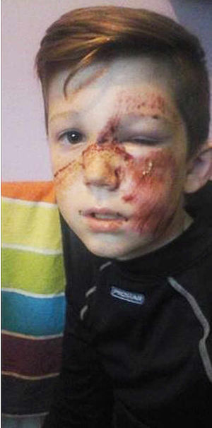 Ashley suffered facial injuries, clearly visible in this image widely shared on Facebook
