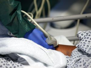 Supporting image for story: Researchers look at link between Covid-19 and cardiovascular diseases