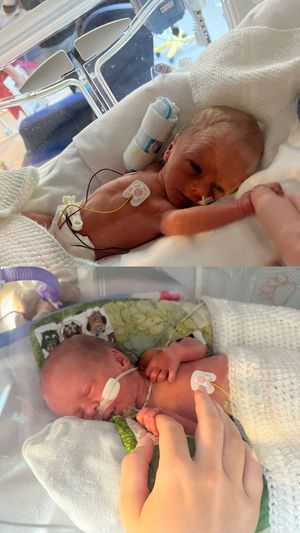 Twins Max and Ronnie, just after they were born at Birmingham Women's Hospital. 
