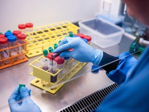 Supporting image for story: Oxford Covid-19 vaccine ‘could be licensed for use in the elderly’