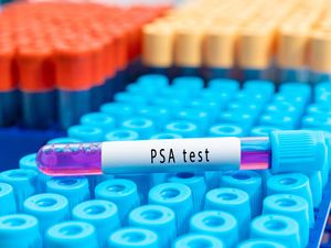 Supporting image for story: Ads for ‘misleading’ prostate supplements and home testing kits banned