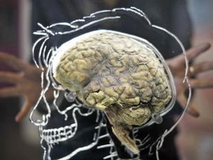 Supporting image for story: Human brain size evolved gradually over three million years, researchers say