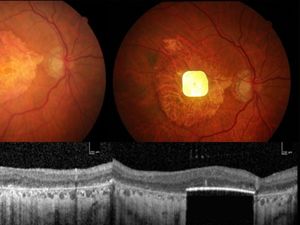 Supporting image for story: What is the Prima device and how does it work?