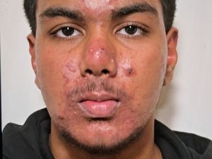 Supporting image for story: Appeal launched to find missing Cradley Heath teenager