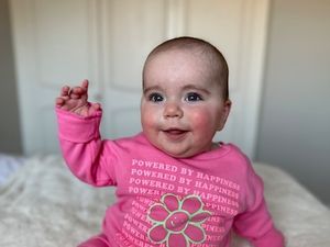 Supporting image for story: Couple raise awareness of rare disorder after baby daughter's 'living nightmare' diagnosis