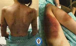 These photos show the extent of the victim's injuries and have been released with her consent