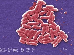 Supporting image for story: E. coli outbreak: 86 people taken to hospital but cases are slowing down
