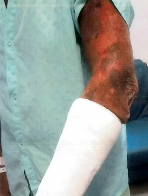 Some of the injuries he was left with