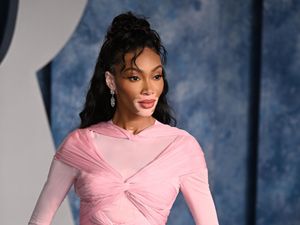 Supporting image for story: Winnie Harlow on the childhood book that inspired her stage name