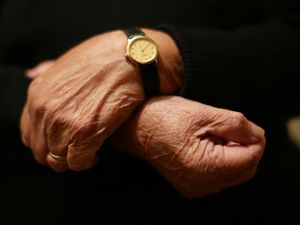 Supporting image for story: Brain’s immune cells ‘could hold the key to slowing Alzheimer’s progression’