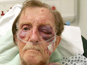 Supporting image for story: Arthur Gumbley: Murder trial told how brutal beating led to 87-year-old's death