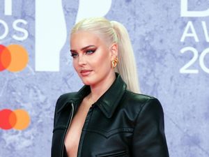 Supporting image for story: Anne-Marie paused therapy and let feelings ‘come back’ to write music