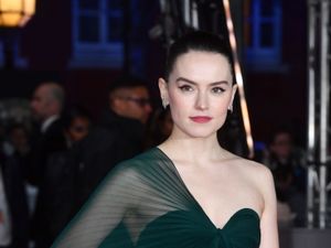 Supporting image for story: Daisy Ridley: What is Graves’ disease?