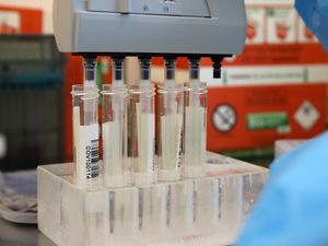 Supporting image for story: South African variant of Covid-19 detected in Northern Ireland