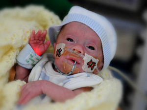Supporting image for story: Brave little fighter Harrison is finally home