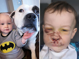 Supporting image for story: Photos reveal two-year-old boy's shocking injuries after being mauled by family Staffordshire bull terrier