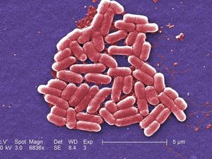 Supporting image for story: Bacterial ‘armour’ could provide a target for new antibiotic drugs