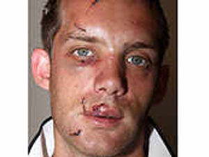 Supporting image for story: Father cut in unprovoked attack