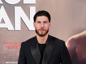 Supporting image for story: Love Island star ‘could have died’ after allergic reaction on flight