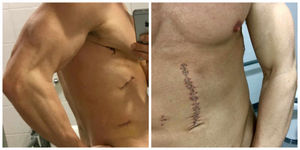 Will needed more than 60 stitches after being left with around 12 knife wounds