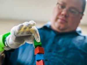 Supporting image for story: Amputees use thought to move individual fingers in bionic limb