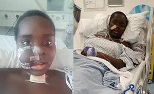 Crystal under went surgery that involved removing part of her cheek where the bone cancer was