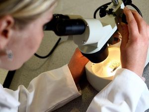 Supporting image for story: Single protein drives growth and spread of deadliest cancer, research shows