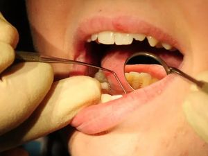 Supporting image for story: New statistics show two in five Year Six children in Wolverhampton West have bad tooth decay and Sandwell child obesity is high