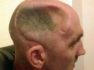 Supporting image for story: Star Comment: Toughen up law on punching