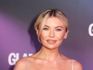 Supporting image for story: Reality TV star Georgia Toffolo says her skin has been her ‘biggest struggle’