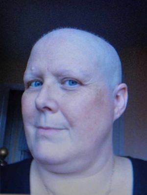 Mum Ruth during her cancer treatment