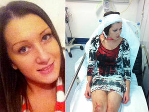 Supporting image for story: Beauty therapist speaks out after Halesowen nightclub glass attack leaves her scarred for life