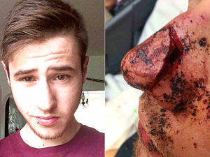 Supporting image for story: Nightclub owner condemns vicious Telford attack