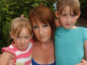Supporting image for story: Telford mother bitten in dog attack