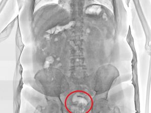 Supporting image for story: X-ray scanners rolled at prisons in West Midlands and Staffordshire