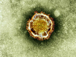 Supporting image for story: LETTER: Welsh government right to take care over coronavirus