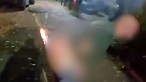 Man suffers burns after trying to launch a firework from his bottom in Birmingham.
