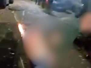 Supporting image for story: Moment man suffered burns after trying to launch firework from bottom in Birmingham