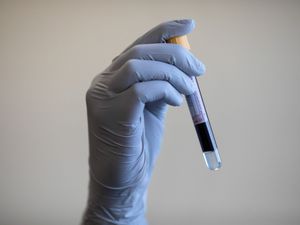 Supporting image for story: Blood test shows promising results in detecting cancer early, study says
