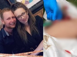 Supporting image for story: Cricketer suffers freak injury as spike gets impaled in his leg during match