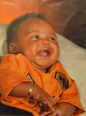 Kaiden at 3 months old. His skin conditions did not appear until he was five years old.