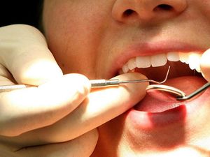 Supporting image for story: A robot dentist just completed its first solo procedure