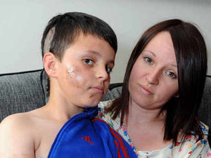 Supporting image for story: Savaged boy is so 'lucky to be alive'
