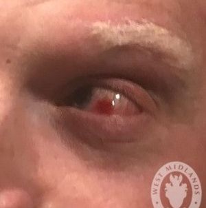 Supporting image for story