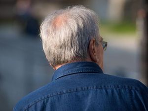 Supporting image for story: ‘New evidence’ shows how acute stress can lead to grey hair