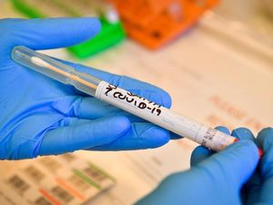 Supporting image for story: Coronavirus: Police warning after people knock on doors asking to test for virus in Tern Hill