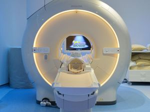 Supporting image for story: AI can tell from brain scans who will suffer worst from brain tumour – study