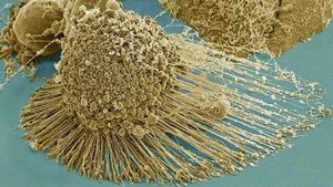 Supporting image for story