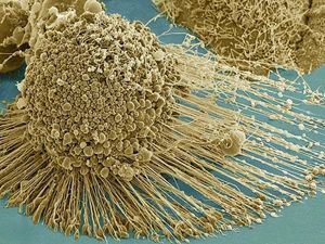 Supporting image for story: New technique 'breaks the legs' of cancer tumour cells